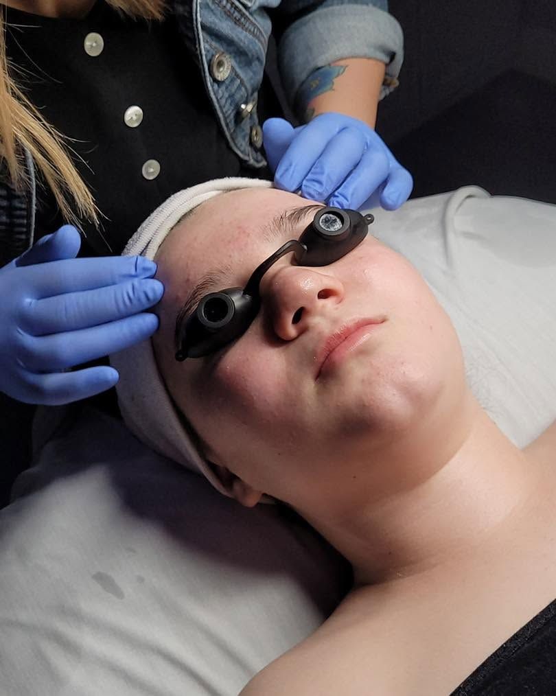 Client wearing protective eyewear during a JetPeel and light treatment
